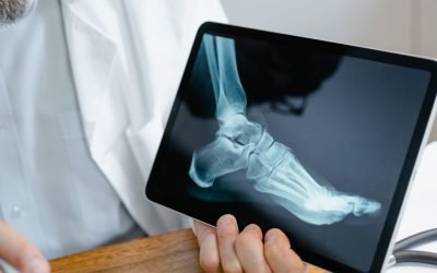 EMS Training for Brittle Bones: Safe Fitness for Joint Pain, Osteoporosis, and Aging Bodies