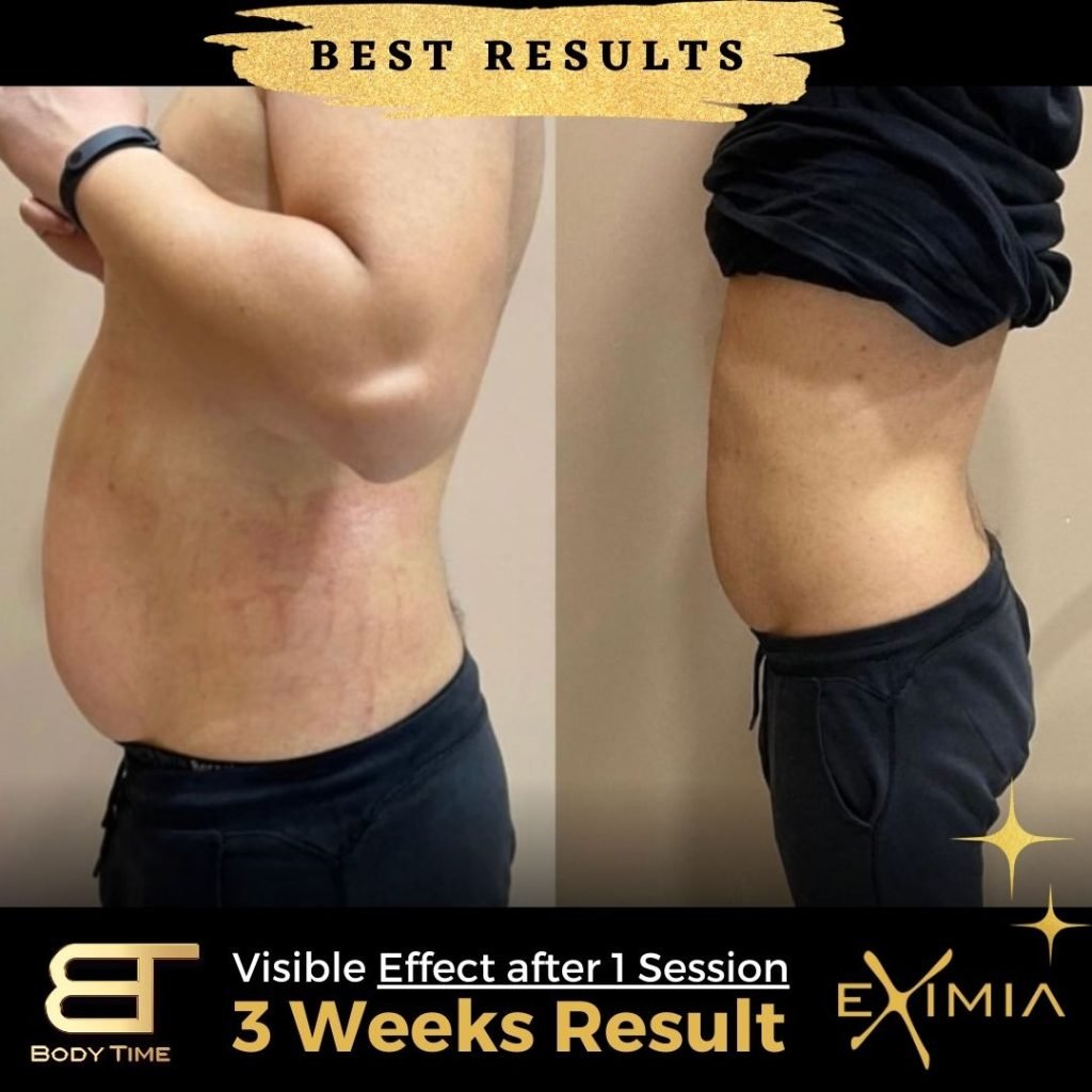 Eximia Dubai Best Results Weight Loss Fast