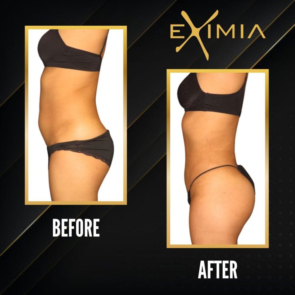 Eximia Dubai Before After 1