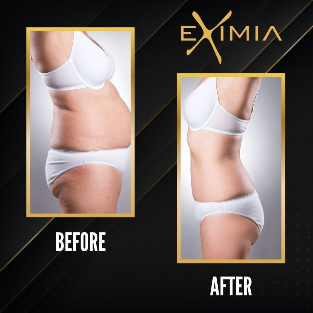 Eximia Dubai Before After 2